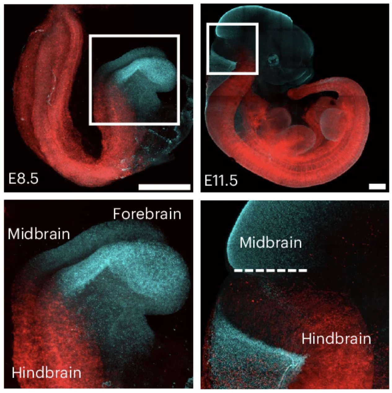Four images of the developing brain, all showing distinct red and cyan regions.