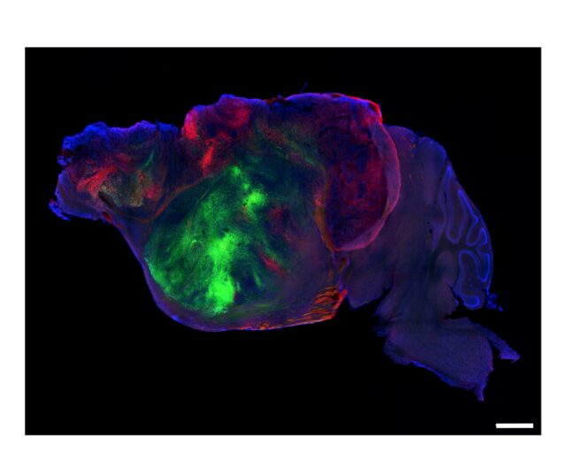 Researchers swap in human brain cells for a mouse's cortex