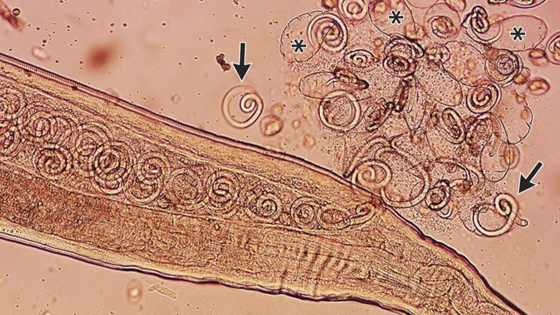 What's worse than having eye worms? Having eye worms with babies.