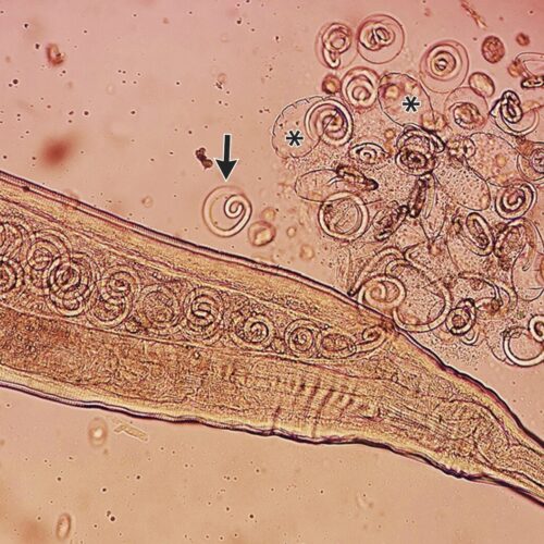 What's worse than having eye worms? Having eye worms with babies.