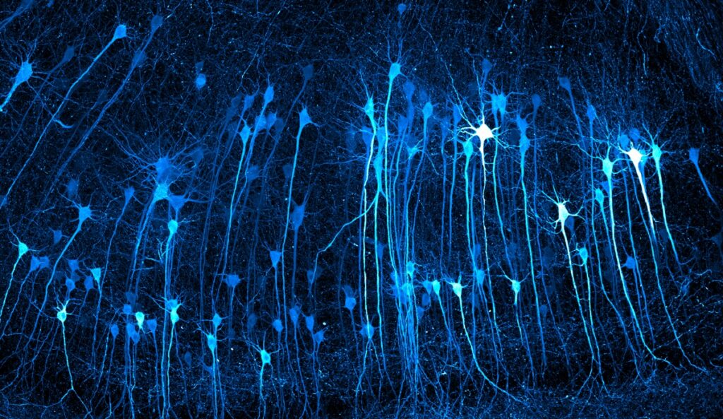 neurons in an expanded mouse brain