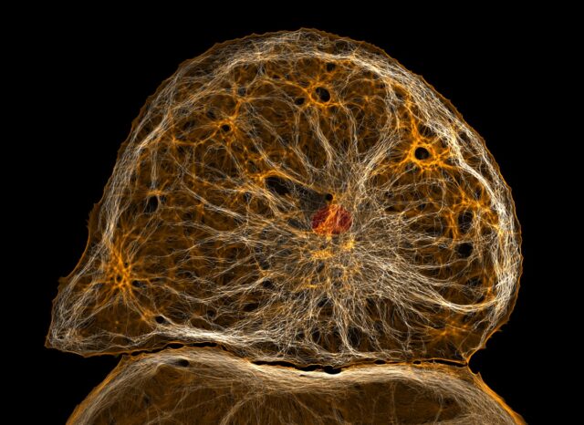 De-differentiated liver endothelial cell