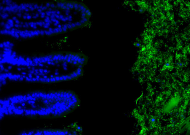 Gut bacteria (green) keep a safe distance from the surface of the intestine (blue).