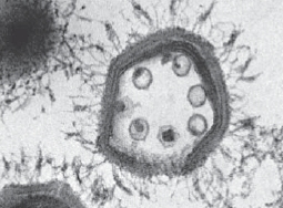 Sputnik the virophage: a virus gets a virus - Ars Technica