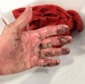Katy Emslie's hand after her Power Bar exploded